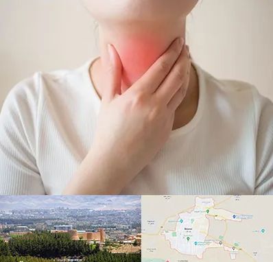 دکتر سرطان مری در بیرجند