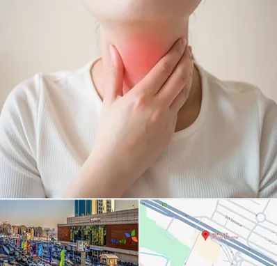 دکتر سرطان مری در لاله پارک تبریز