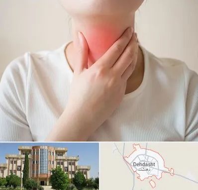 دکتر سرطان مری در دهدشت