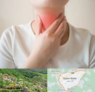 دکتر سرطان مری در قائم شهر