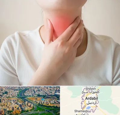 دکتر سرطان مری در اردبیل