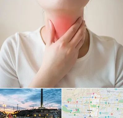 دکتر سرطان مری در منطقه 2 تهران 