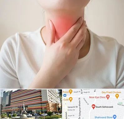 دکتر سرطان مری در سهروردی 