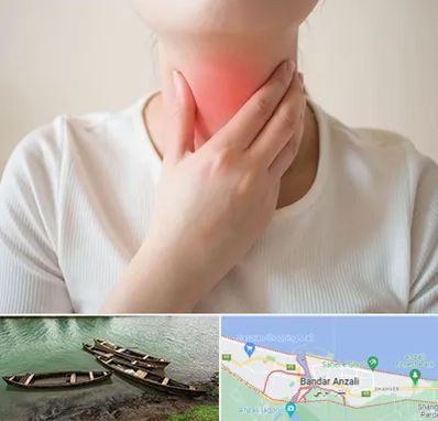 دکتر سرطان مری در بندر انزلی