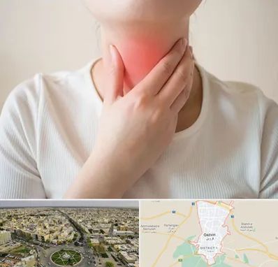 دکتر سرطان مری در قزوین