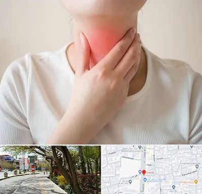 دکتر سرطان مری در خیابان توحید اصفهان 