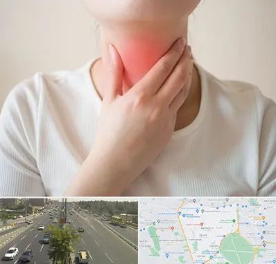 دکتر سرطان مری در منطقه 17 تهران 