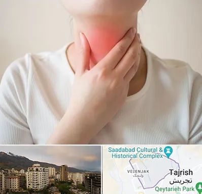 دکتر سرطان مری در زعفرانیه