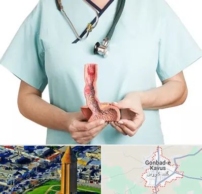 جراح سرطان مری در گنبد کاووس