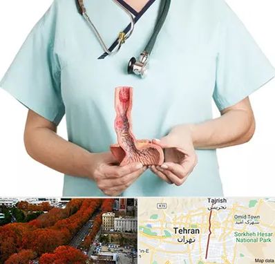 جراح سرطان مری در ولیعصر 