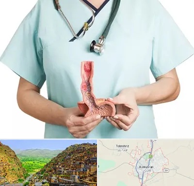 جراح سرطان مری در کامیاران