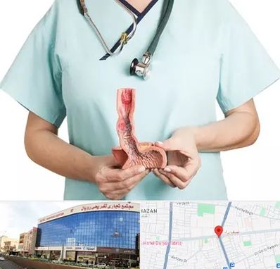 جراح سرطان مری در نصف راه تبریز