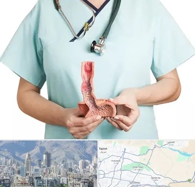 جراح سرطان مری در شمال شرق تهران