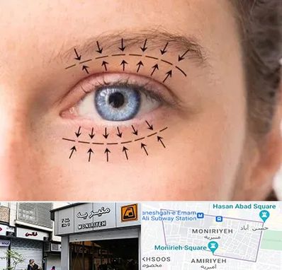 عمل افتادگی پلک در منیریه