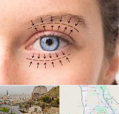 عمل افتادگی پلک در فرهنگ شهر شیراز