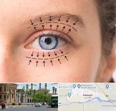 عمل افتادگی پلک در پاکدشت