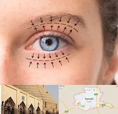 عمل افتادگی پلک در ساوه