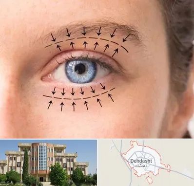 عمل افتادگی پلک در دهدشت