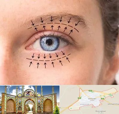 عمل افتادگی پلک در سمنان