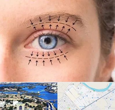 عمل افتادگی پلک در کوروش اهواز