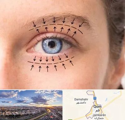 عمل افتادگی پلک در قم