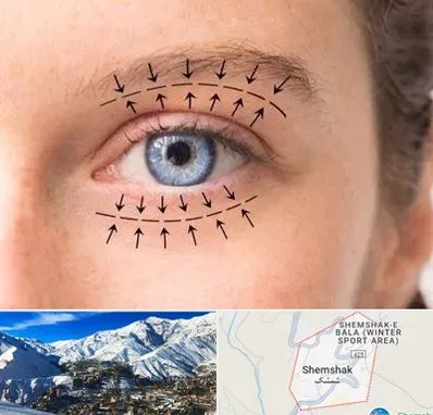 عمل افتادگی پلک در شمشک