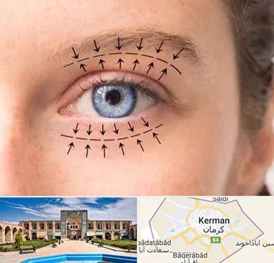 عمل افتادگی پلک در کرمان