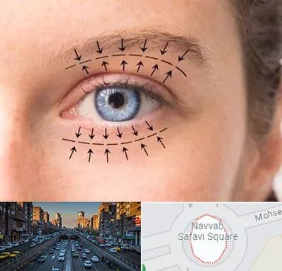 عمل افتادگی پلک در نواب