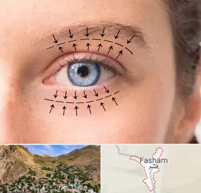 عمل افتادگی پلک در فشم