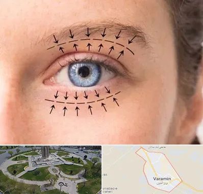 عمل افتادگی پلک در ورامین
