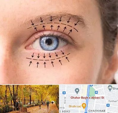 عمل افتادگی پلک در چهارباغ اصفهان
