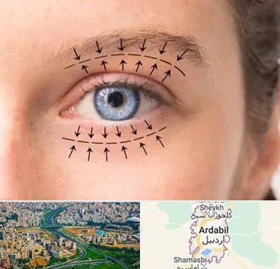 عمل افتادگی پلک در اردبیل