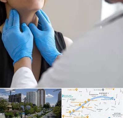 دکتر سرطان گلو در اندرزگو 