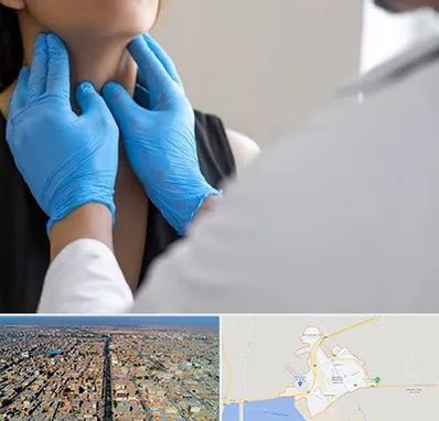 دکتر سرطان گلو در بندر ماهشهر