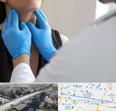 دکتر سرطان گلو در فرجام 