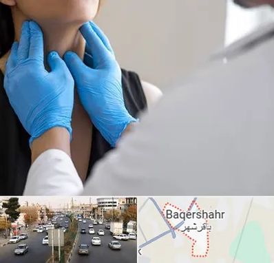 دکتر سرطان گلو در باقرشهر