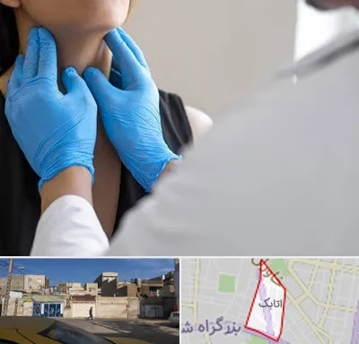 دکتر سرطان گلو در اتابک