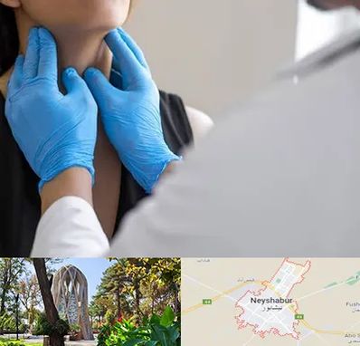 دکتر سرطان گلو در نیشابور