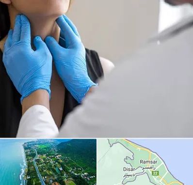 دکتر سرطان گلو در رامسر