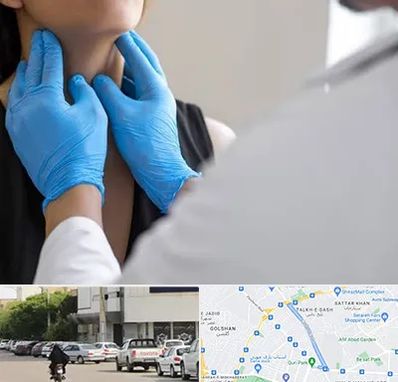 دکتر سرطان گلو در قدوسی شرقی شیراز 