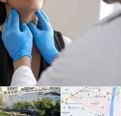 دکتر سرطان گلو در گلستان اهواز 