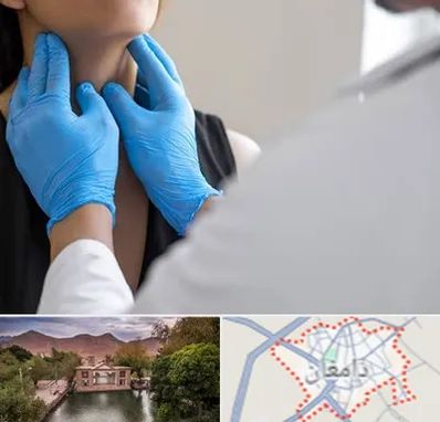 دکتر سرطان گلو در دامغان