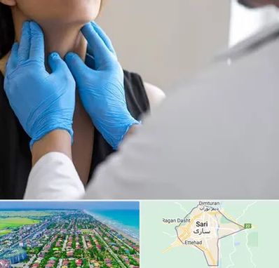 دکتر سرطان گلو در ساری