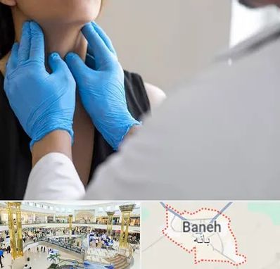 دکتر سرطان گلو در بانه
