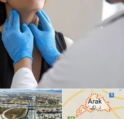 دکتر سرطان گلو در اراک
