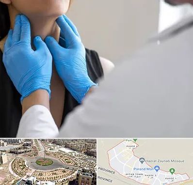 دکتر سرطان گلو در پرند