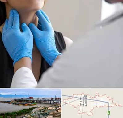 دکتر سرطان گلو در بندر ترکمن