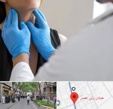 دکتر سرطان گلو در ولیعصر شهریار