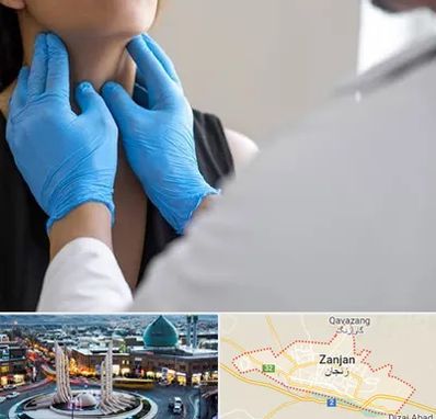 دکتر سرطان گلو در زنجان