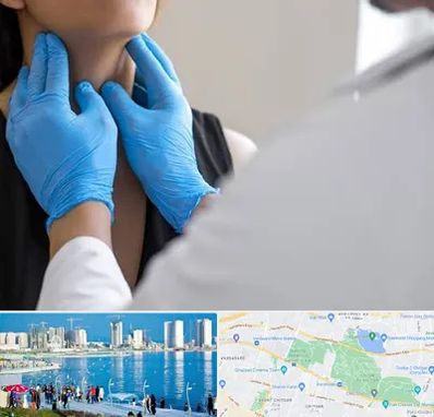 دکتر سرطان گلو در چیتگر 
